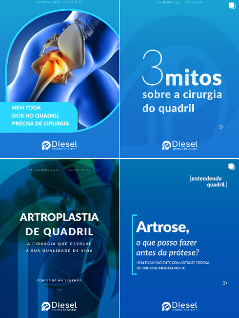 dr-cristiano-diesel-cirurgia-quadril-feed-mob